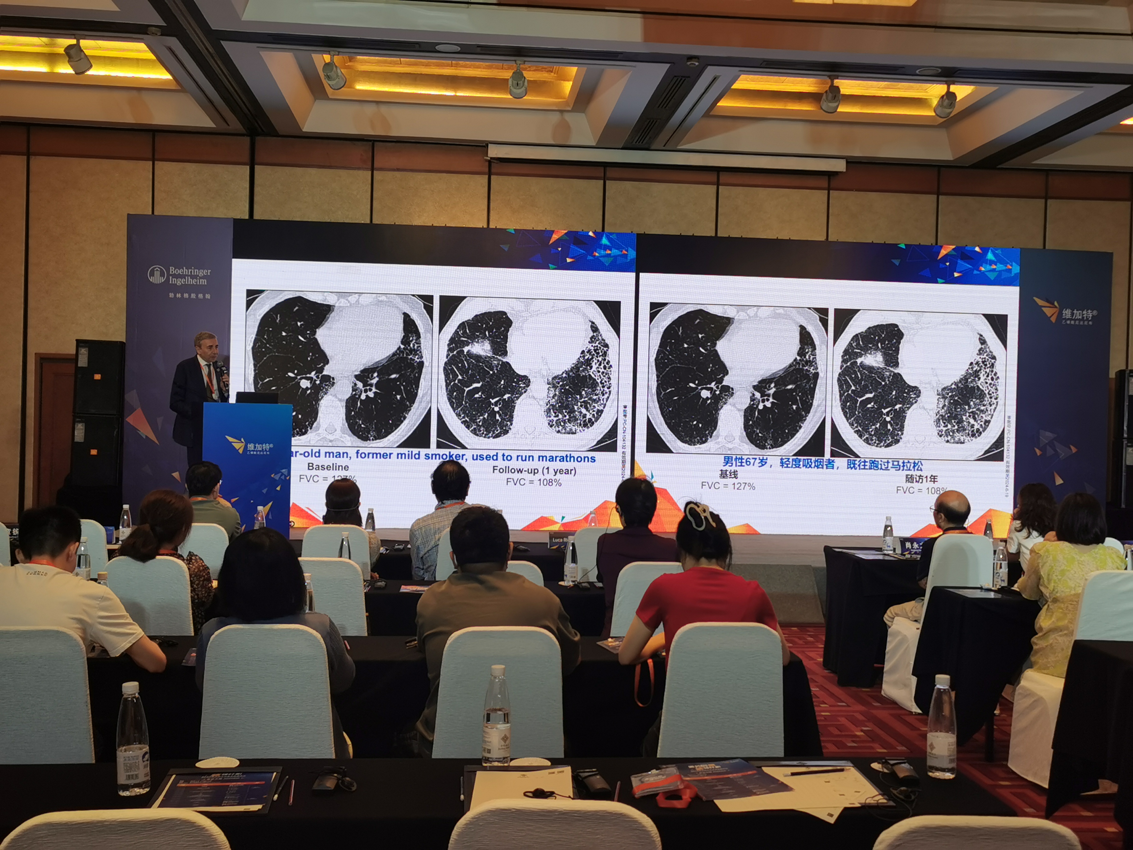 優(yōu)化抗纖維化治療策略 規(guī)范ILD診療丨2023維加特中外學術高峰論壇